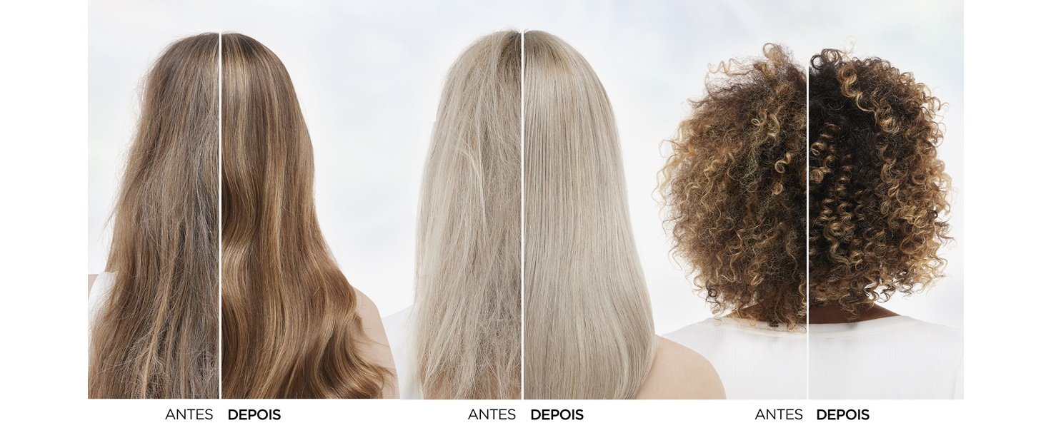Img Antes Depois